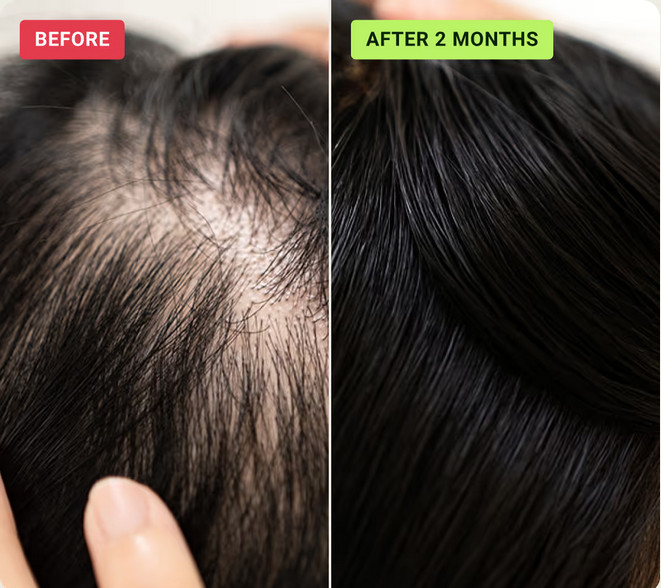 HaloGrow Hair Helper Spray Customer Reviews