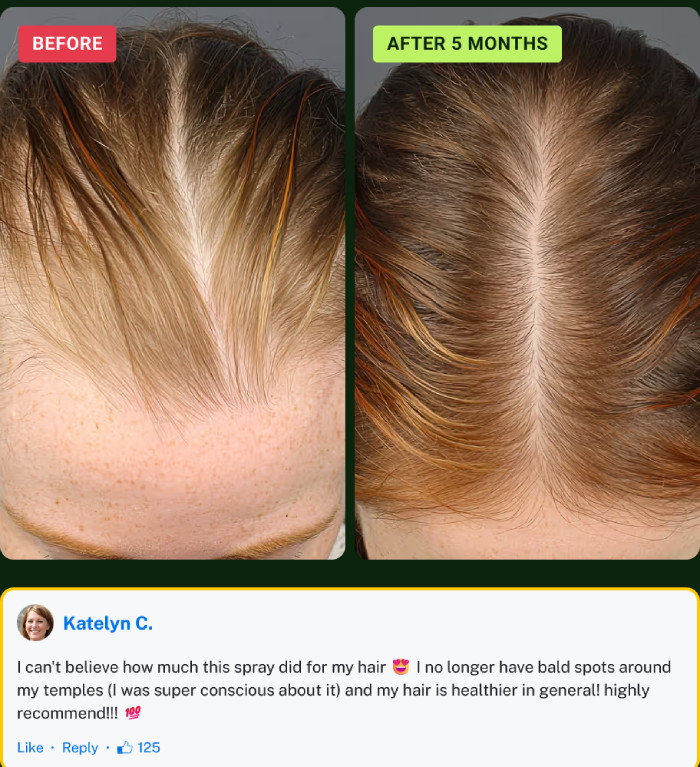 Personal Experience Using Halo Grow Hair Spray